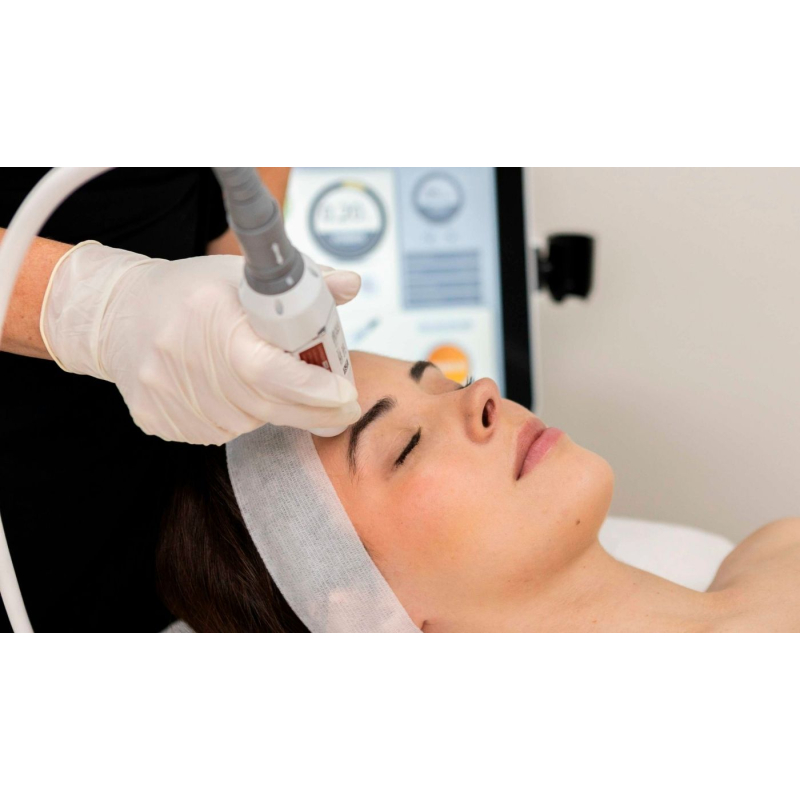HIFU Essential Lift starter treatment for first-time HIFU clients at SBL Beauté Melbourne