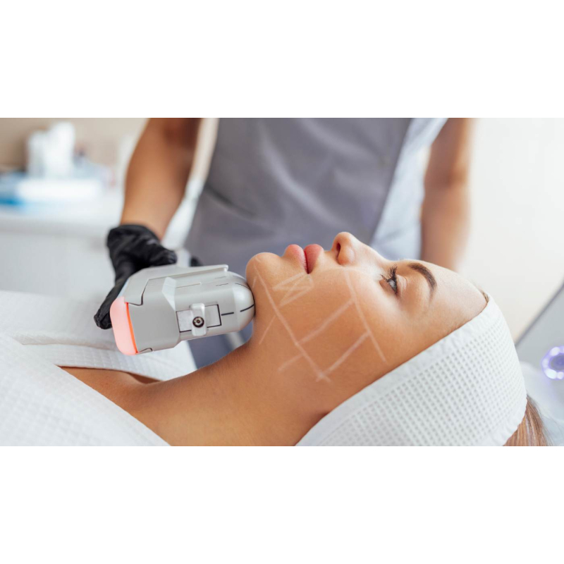 HIFU Neck Contour Lift — jawline definition and neck tightening at SBL Beauté Melbourne